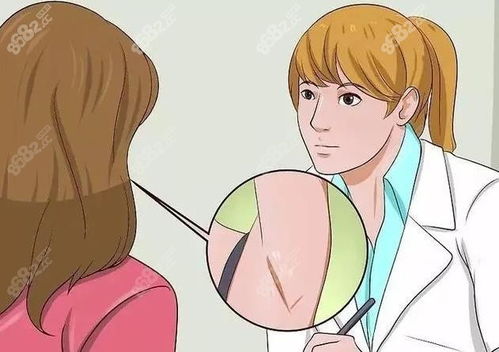 成都腋臭手术医院排名前十与正规治疗机构解析