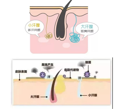 臭术注射液治疗狐臭 效果显现时间与疗程解析